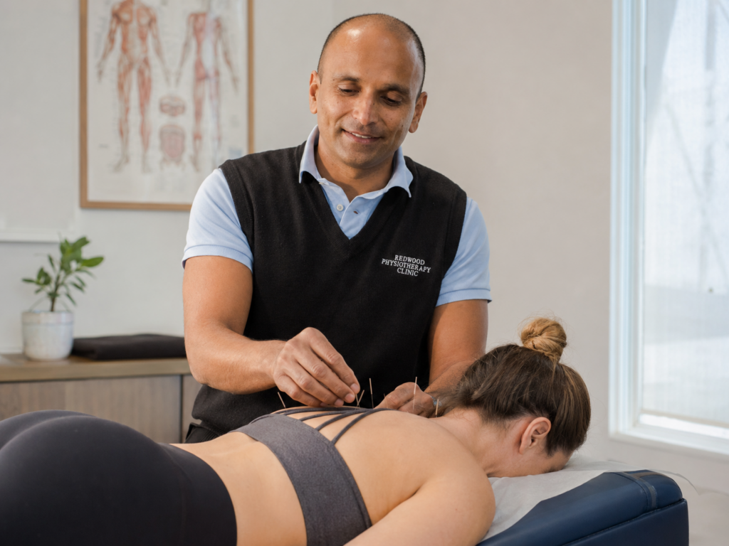 Strapping Acupuncture treatment Christchurch